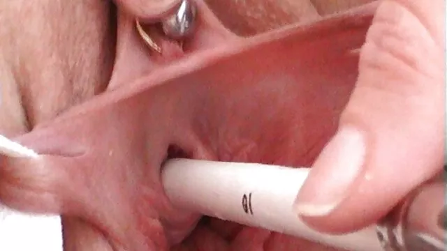 宝贝是搞砸了 巴西肛门